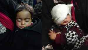 Jammu and Kashmir: 20-month-old baby girl hit in eye by pellet inside her home in Shopian; might lose sight