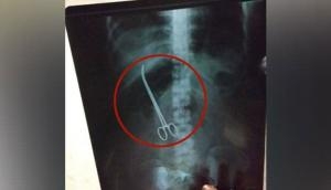 Hyderabad: Shocking! Doctors forget 2 ‘forceps’ in woman’s stomach, found in X-Ray after 3 months; know what happened next