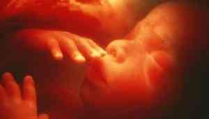 Medical miracle: Unborn baby removed from mother’s womb for surgery in UK, then put back; reason will give you goosebumps