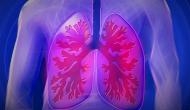 New model developed to predict patients with poor lung cancer outcomes: Research