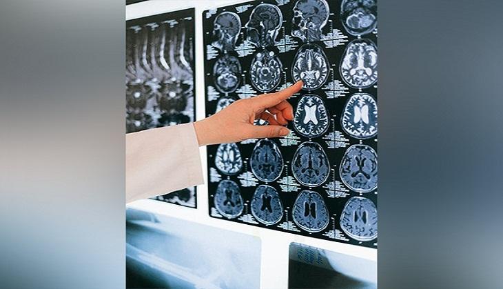 Study: AI-enhanced advancements in dynamic brain imaging | Catch News