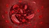 Union Budget 2023: What is sickle cell anaemia? Know all about this blood disorder
